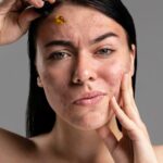 चेहरे पर काले दाग-धब्बे हटाने का घरेलू उपाय