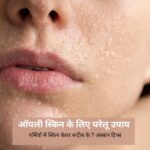 ऑयली स्किन के लिए घरेलू उपाय