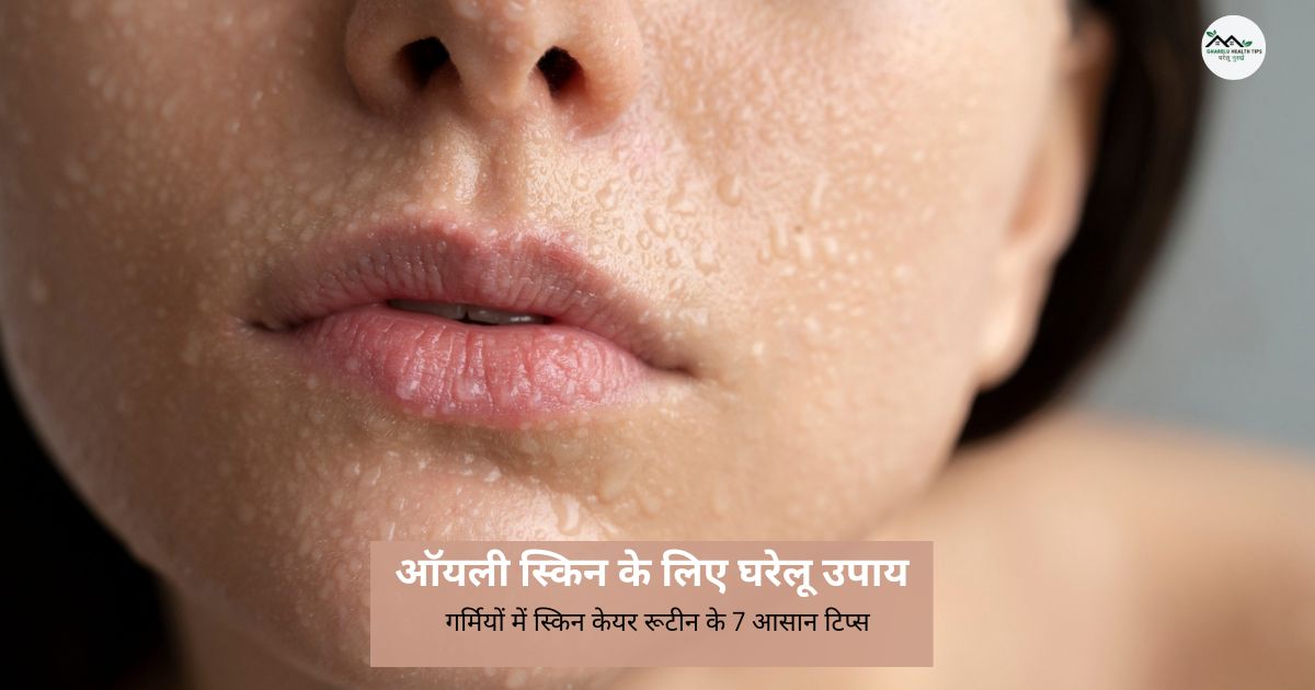 ऑयली स्किन के लिए घरेलू उपाय