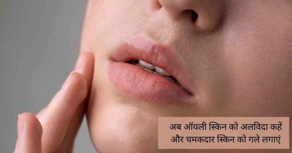 oily skin dur karne ke upay
