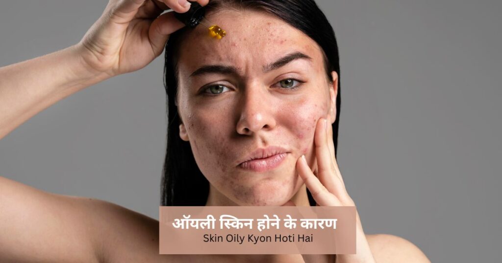 ऑयली स्किन होने के कारण