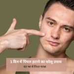 1 दिन में पिंपल हटाने का घरेलू उपाय