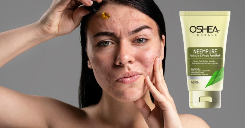 ओशिया हर्बल्स नीम प्योर एंटी एक्ने और पिंपल फेस वॉश