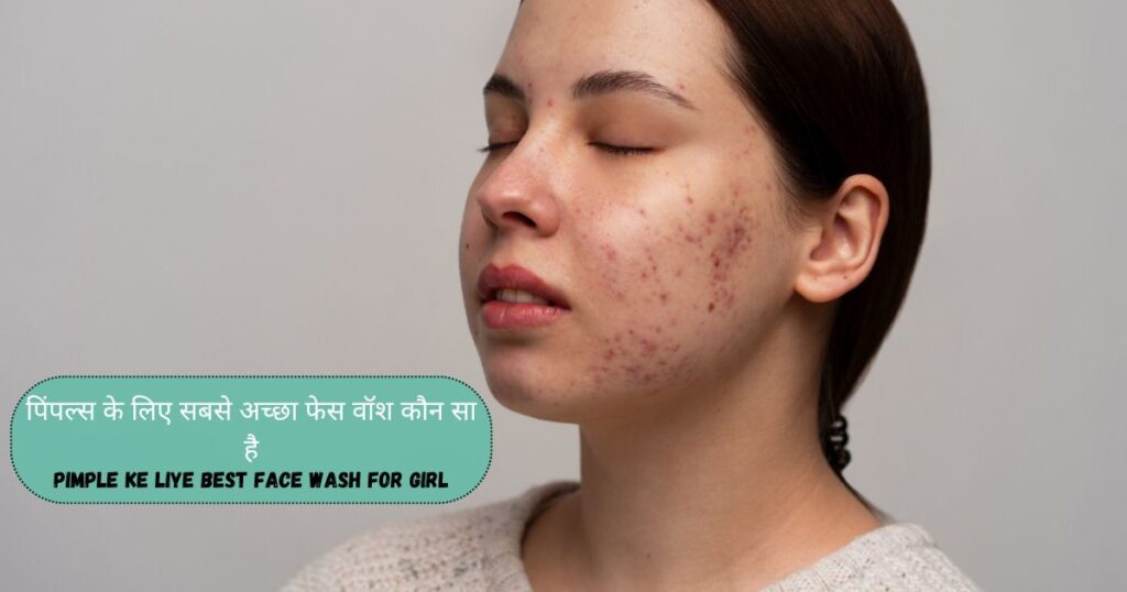 Pimple Ke Liye Best Face Wash For Girl