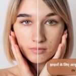 झाइयों के लिए आयुर्वेदिक क्रीम कौन सी है