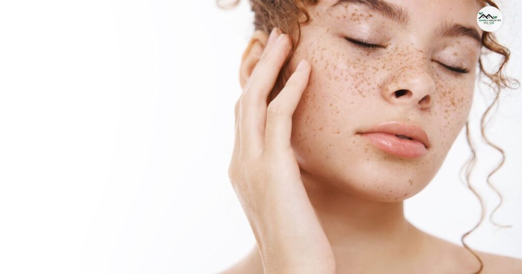 झाइयों के लिए आयुर्वेदिक क्रीम कौन सी है? Top 6 क्रीम्स 2 झाइयों के लिए आयुर्वेदिक क्रीम कौन सी है