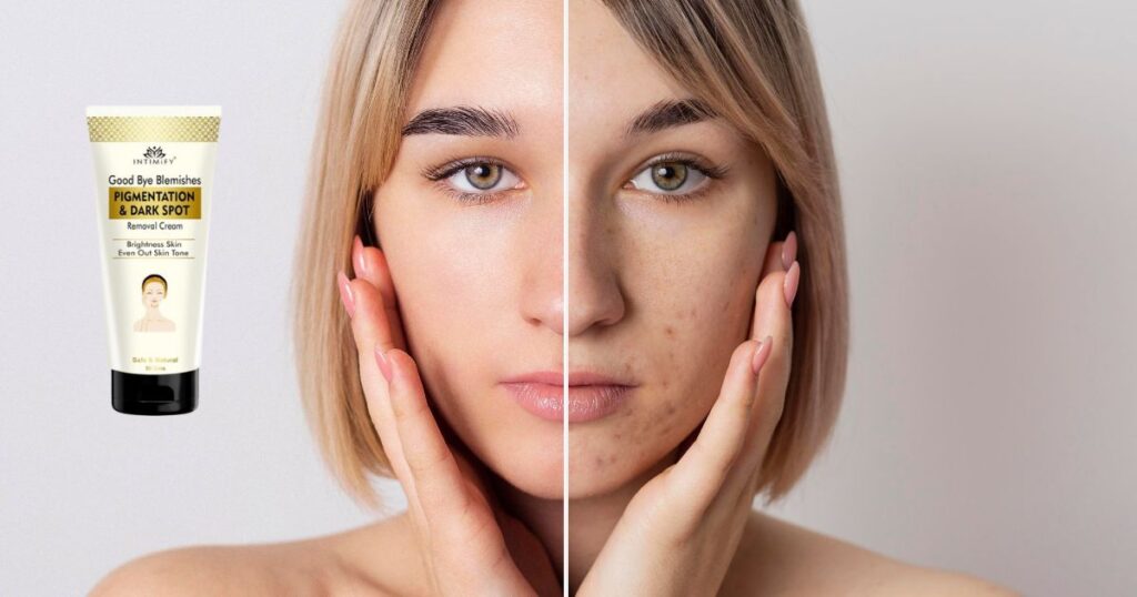 झाइयों के लिए आयुर्वेदिक क्रीम कौन सी है? Top 6 क्रीम्स 5 झाइयों के लिए आयुर्वेदिक क्रीम कौन सी है? Top 6 क्रीम्स