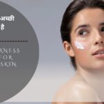 गोरे होने की सबसे अच्छी क्रीम कौन सी है (Top 10 Fairness Creams for Glowing Skin) 41 गोरे होने की सबसे अच्छी क्रीम कौन सी है